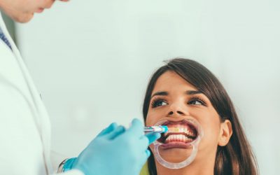 BLANQUEAMIENTO DENTAL, SEGURO Y EFECTIVO